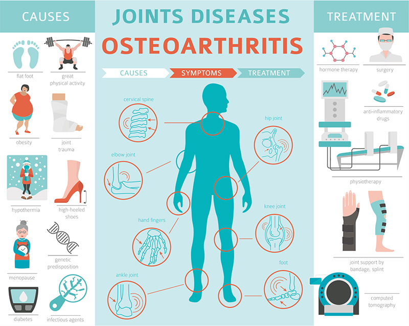 most important risk factor for osteoarthritis